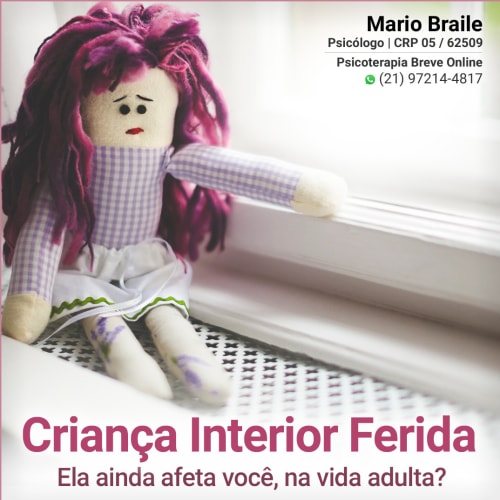 Foto 5 de Mario Alesandro Braile